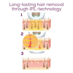 Фотоепилатор Beurer IPL 8800 Velvet Skin Pro Hair-remover, battery powered, Auto flash, 4.5 cm2, 1 attachment 2 cm2, 600 000 pulses, safe skin sensor, UV filter, 6 energy levels, black